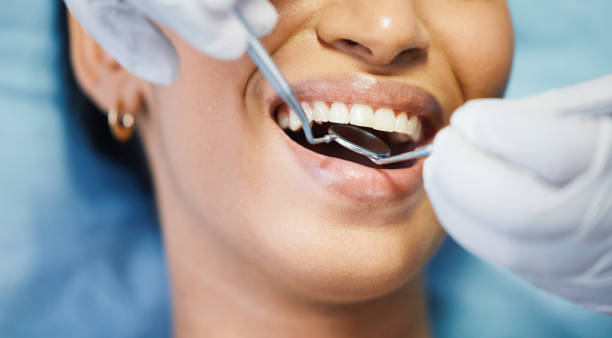 Best Broken or Cracked Tooth Emergency Dentist in Midway South, TX