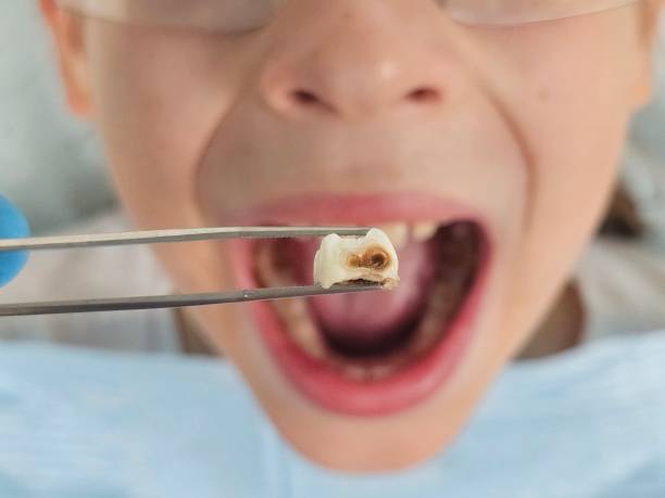 Best Mobile Emergency Dentist in Midway South, TX