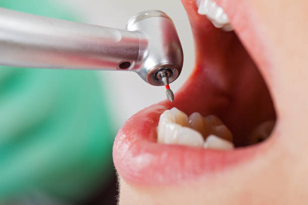 Best Broken or Cracked Tooth Emergency Dentist in Midway South, TX